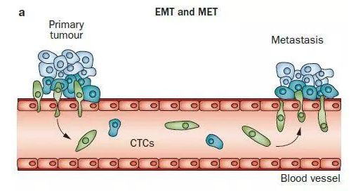 液体活检专题（四）——CTC的概念、特点和应用案例
