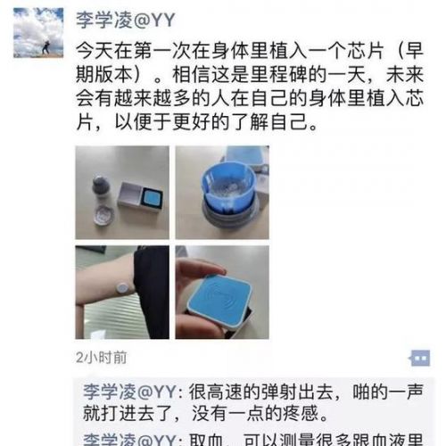AI医疗探索前行：YY创始人李学凌体内植入芯片真相调查