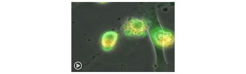 NEJM连发两篇重磅 改写宫颈癌治疗模式？