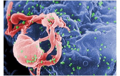 PLoS Pathog：控制HIV潜伏的机制在血液和肠道中存在差异