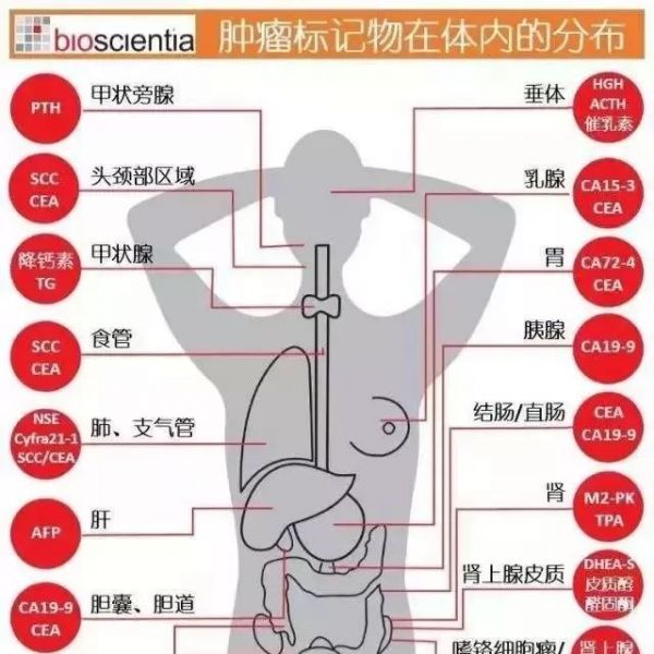 肿瘤标志物分布图，值得收藏！