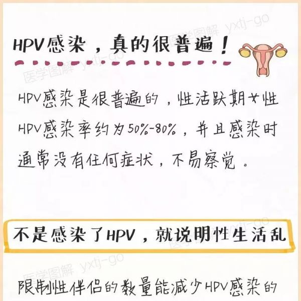 HPV感染，看完这篇就懂啦！
