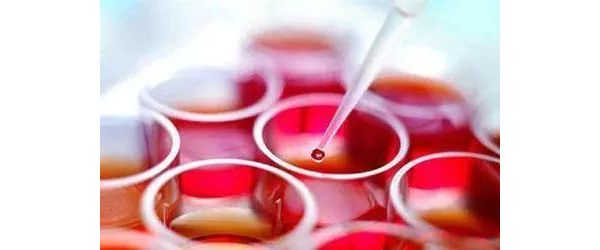 Geisinger Health和约翰霍普金斯大学共同研制液体活检法，用于癌症基因的早期检测