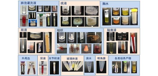 博奥MAPMI助力临床复杂感染筛查