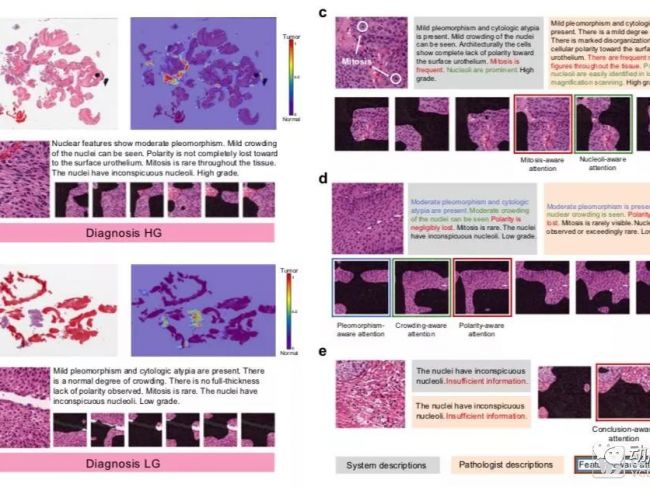 《Nature》子刊提出AI病理诊断解释方案，或解决人工智能CFDA三类申报获批关键难点
