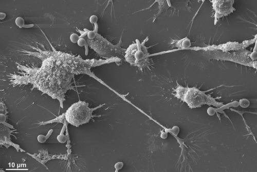 Pathogen检测？下一个NIPT级别的NGS临床应用？