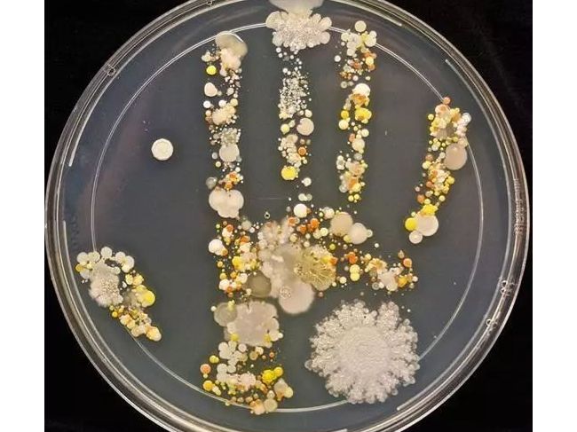 微生物检测基础知识大全！（包含微生物检测的接种、培养、分离纯化、鉴定和保存等）