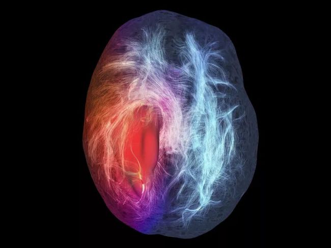 Nature子刊：血液检测诊断“恶性脑瘤”，侵入性更小、结果更快
