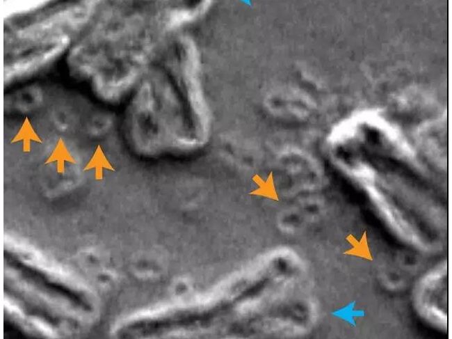 《Nature》重磅！科学家发现：染色体外DNA，导至癌症恶变的罪魁！