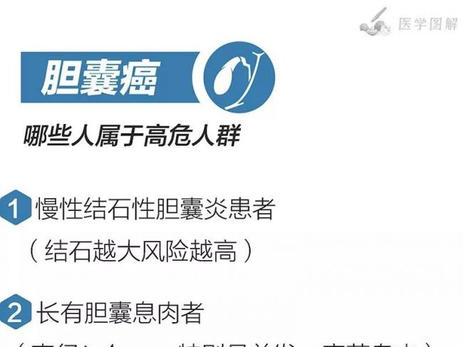 这4种癌症筛查，一图快速看全！