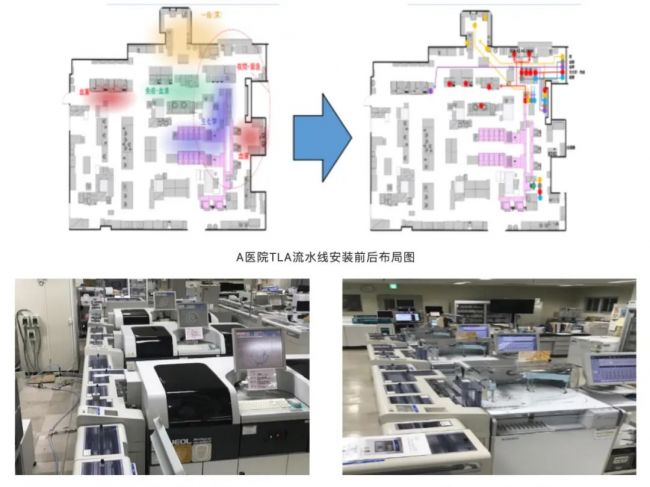 “匠心之作”丨凝血检验自动化