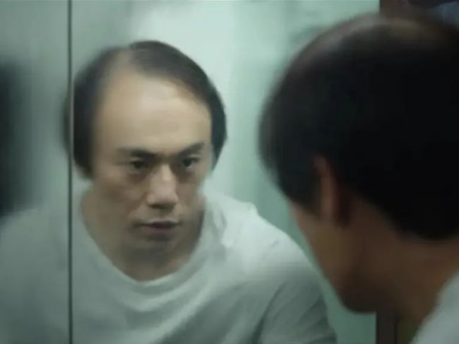 小RNA解决头等大问题：程柯团队发现外泌体中的miRNA是促进头发再生的关键