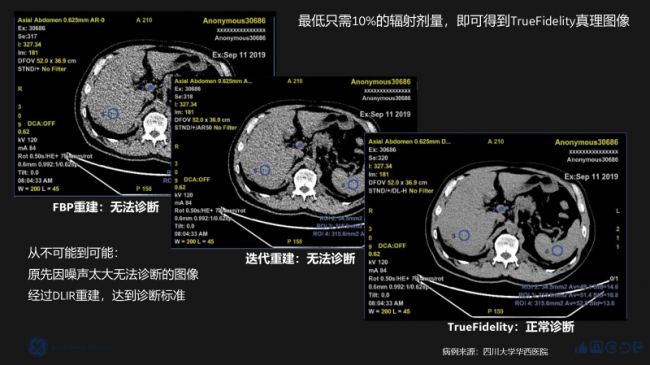 医疗AI成下一个蓝海，医械巨头如何抢滩？