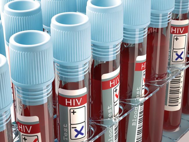 罗氏诊断首个HIV-1/HIV-2定性检测试剂获FDA批准