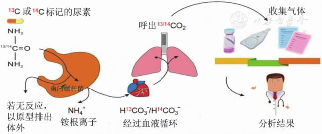 幽门螺杆菌-尿素呼气试验临床应用专家共识（2020年）