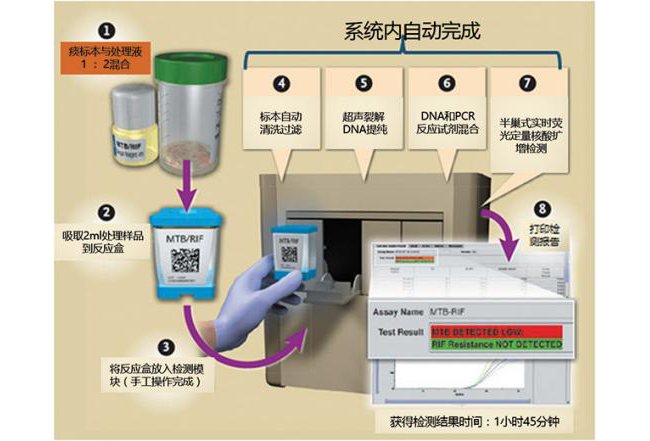 宋海波：后疫情时期，呼吸道症候群病原体多重检测的重要意义！