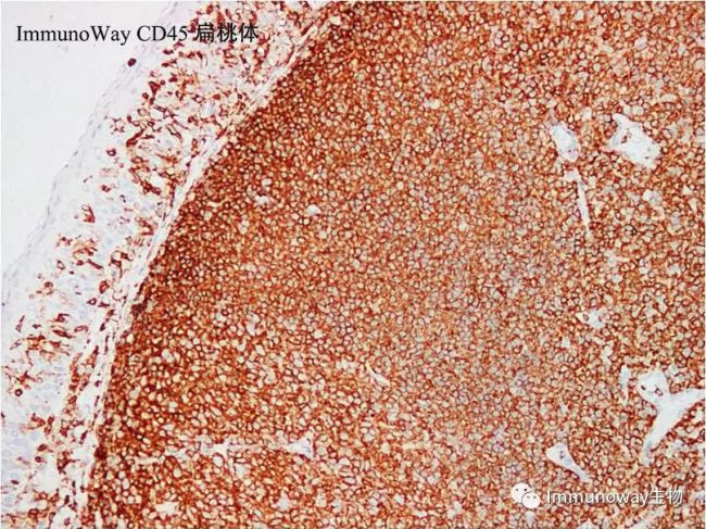 免疫组织化学（IHC）实验方法总结