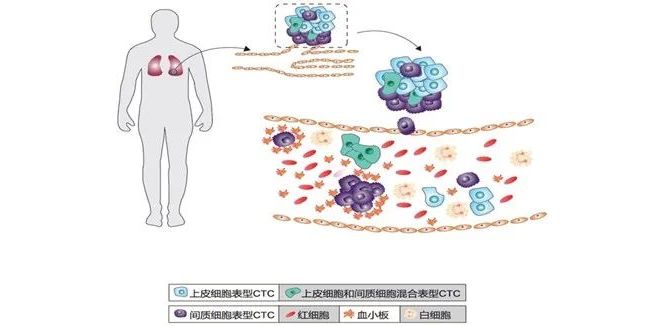 液体活检CTC技术简析：是鸡肋还是机遇？