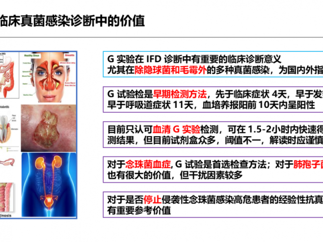 真菌感染实验室诊断：究竟该信哪个“G”？ ——从真菌感染临床诊疗思路看检验：G，GM ...