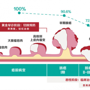 IVD市场丨结直肠癌诊疗市场分析