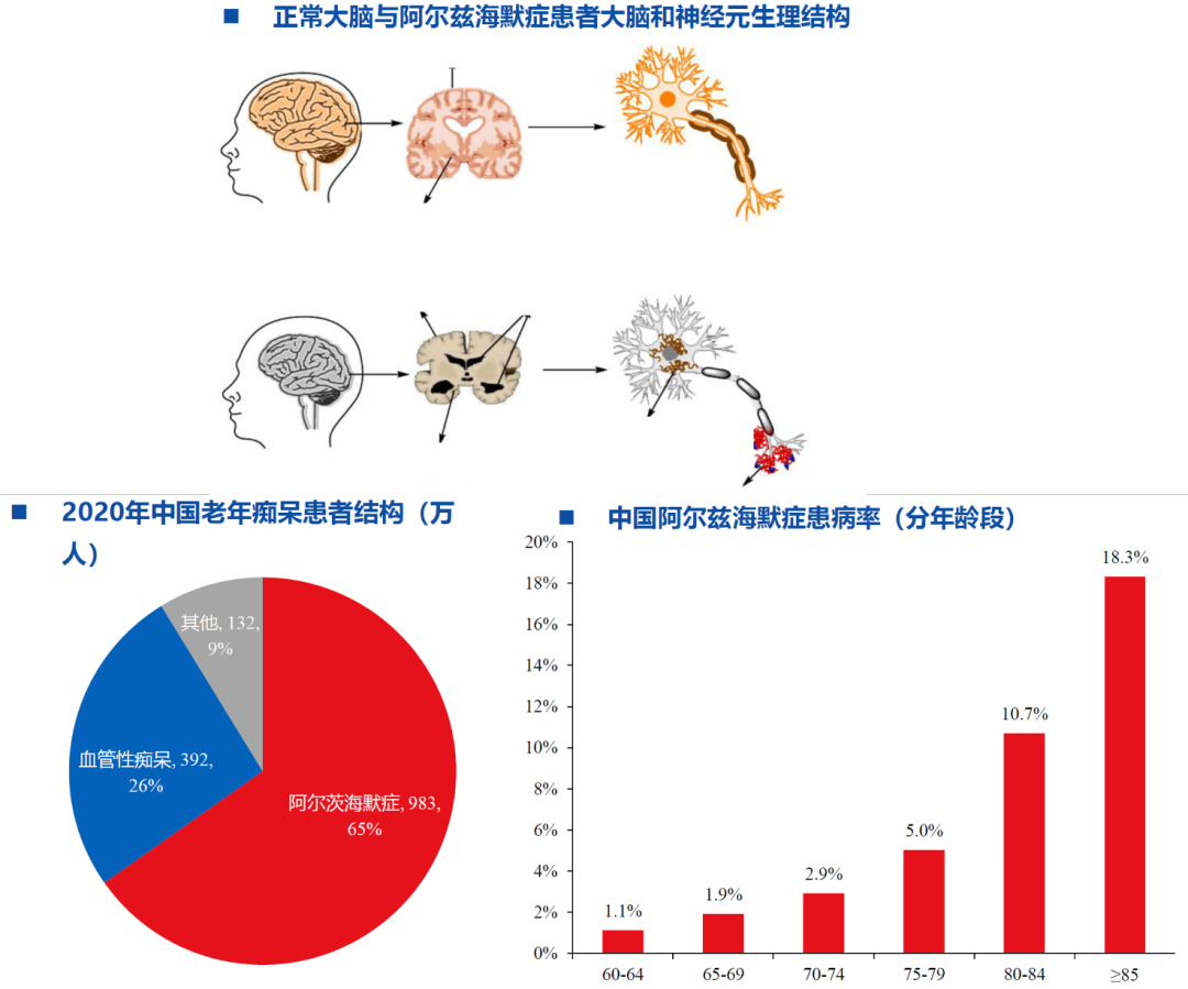 阿尔兹海默症诊断产业链梳理，市场布局盘点！